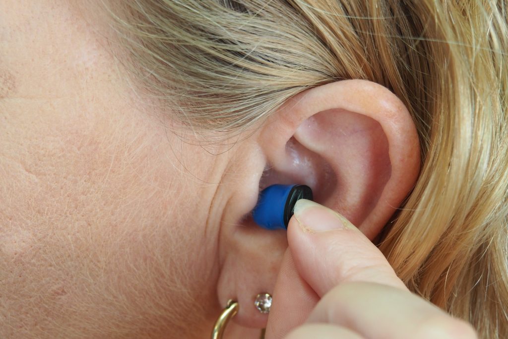 acupuncture for tinnitus